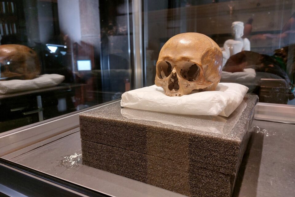 Le crâne de Saint-Aubert à Avranches protégé pour la séparation avec le reliquaire